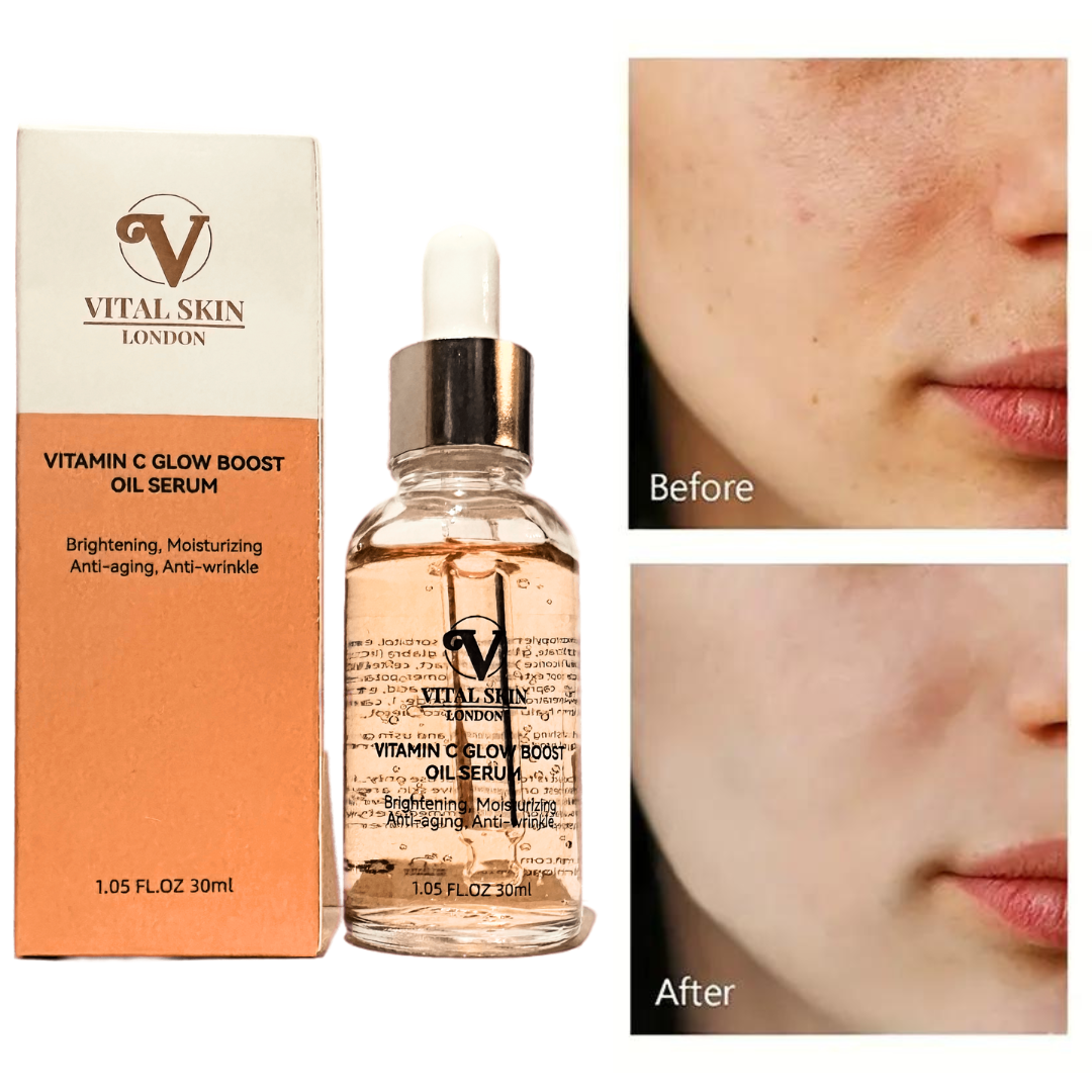 Vitamin C serum for Skin Glow 30ml